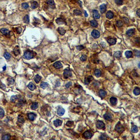 19 - Recombinant Anti-HSP90 alpha/beta Rabbit mAb AP94936