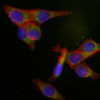 3 - Recombinant Anti-ACLY Rabbit mAb AP94938