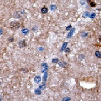 19 - Recombinant Anti-ACLY Rabbit mAb AP94938