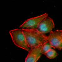3 - Recombinant Anti-Cytokeratin 16 Rabbit mAb AP94939