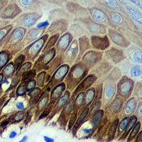 19 - Recombinant Anti-Cytokeratin 16 Rabbit mAb AP94939