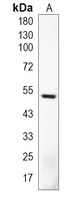1 - Recombinant Anti-Cytokeratin 16 Rabbit mAb AP94939