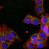 3 - Recombinant Anti-GP73 Rabbit mAb AP94940