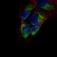 3 - Recombinant Anti-MMP8 Rabbit mAb AP94941
