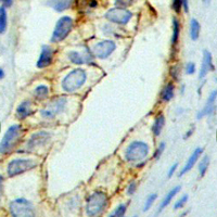 19 - Recombinant Anti-TSC2 Rabbit mAb AP94943