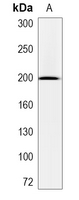 1 - Recombinant Anti-TSC2 Rabbit mAb AP94943