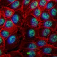3 - Recombinant Anti-NANOG Rabbit mAb AP94945
