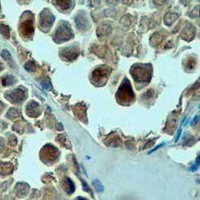 19 - Recombinant Anti-NANOG Rabbit mAb AP94945