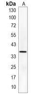 1 - Recombinant Anti-NANOG Rabbit mAb AP94945