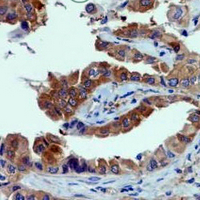 19 - Recombinant Anti-SGK1 Rabbit mAb AP94946