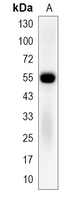1 - Recombinant Anti-SGK1 Rabbit mAb AP94946
