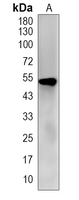 1 - Recombinant Anti-ERR alpha Rabbit mAb AP94947