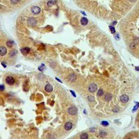 19 - Recombinant Anti-MST2 Rabbit mAb AP94948
