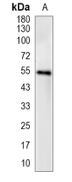 1 - Recombinant Anti-JNK2 Rabbit mAb AP94949