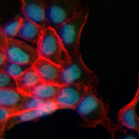 3 - Recombinant Anti-c-Myc (Phospho-T58) Rabbit mAb AP94950