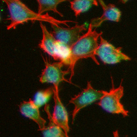 3 - Recombinant Anti-EIF5A Rabbit mAb AP94951