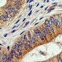 19 - Recombinant Anti-EIF5A Rabbit mAb AP94951