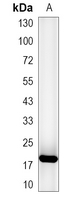 1 - Recombinant Anti-EIF5A Rabbit mAb AP94951
