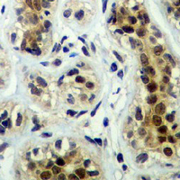 19 - Recombinant Anti-Cortactin Rabbit mAb AP94952