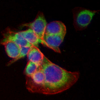 3 - Recombinant Anti-Radixin Rabbit mAb AP94953