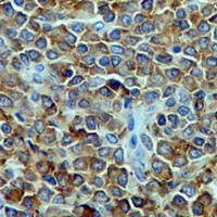 19 - Recombinant Anti-Radixin Rabbit mAb AP94953
