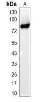 1 - Recombinant Anti-Radixin Rabbit mAb AP94953