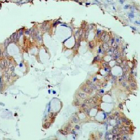 19 - Recombinant Anti-Gamma-enolase Rabbit mAb AP94954