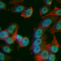 3 - Recombinant Anti-p63 Rabbit mAb AP94955