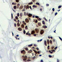 19 - Recombinant Anti-p63 Rabbit mAb AP94955