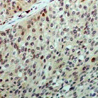 19 - Recombinant Anti-PRPF19 Rabbit mAb AP94957