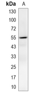 1 - Recombinant Anti-PRPF19 Rabbit mAb AP94957