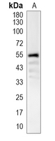 1 - Recombinant Anti-BPI Rabbit mAb AP94960