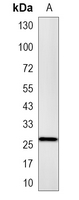 1 - Recombinant Anti-NQO2 Rabbit mAb AP94961