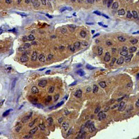 19 - Recombinant Anti-MEKK2 Rabbit mAb AP94962