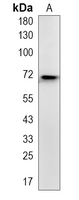 1 - Recombinant Anti-MEKK2 Rabbit mAb AP94962