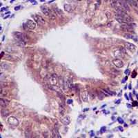 19 - Recombinant Anti-PGHS-1 Rabbit mAb AP94963