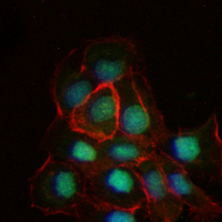 3 - Recombinant Anti-TCF7L2 Rabbit mAb AP94964