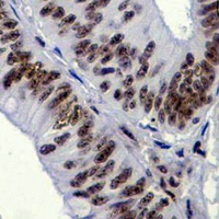 19 - Recombinant Anti-TCF7L2 Rabbit mAb AP94964