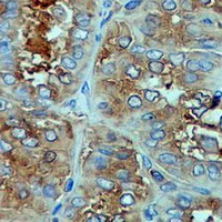 19 - Recombinant Anti-Moesin Rabbit mAb AP94965