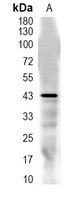 1 - Recombinant Anti-C/EBP alpha Rabbit mAb AP94966