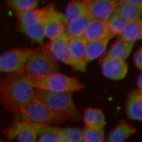 3 - Recombinant Anti-AdipoR1 Rabbit mAb AP94968