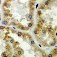19 - Recombinant Anti-AdipoR1 Rabbit mAb AP94968
