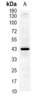 1 - Recombinant Anti-AdipoR1 Rabbit mAb AP94968