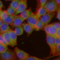 3 - Recombinant Anti-MUC16 Rabbit mAb AP94970
