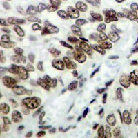 19 - Recombinant Anti-DJ-1 Rabbit mAb AP94971