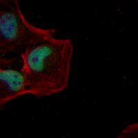 3 - Recombinant Anti-Histone H2B (Acetyl-K20) Rabbit mAb AP94973