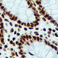 19 - Recombinant Anti-Histone H2B (Acetyl-K20) Rabbit mAb AP94973