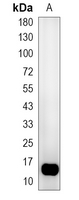 1 - Recombinant Anti-Histone H2B (Acetyl-K20) Rabbit mAb AP94973