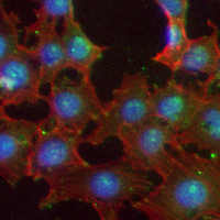 3 - Recombinant Anti-A20 Rabbit mAb AP94974