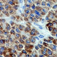 19 - Recombinant Anti-A20 Rabbit mAb AP94974